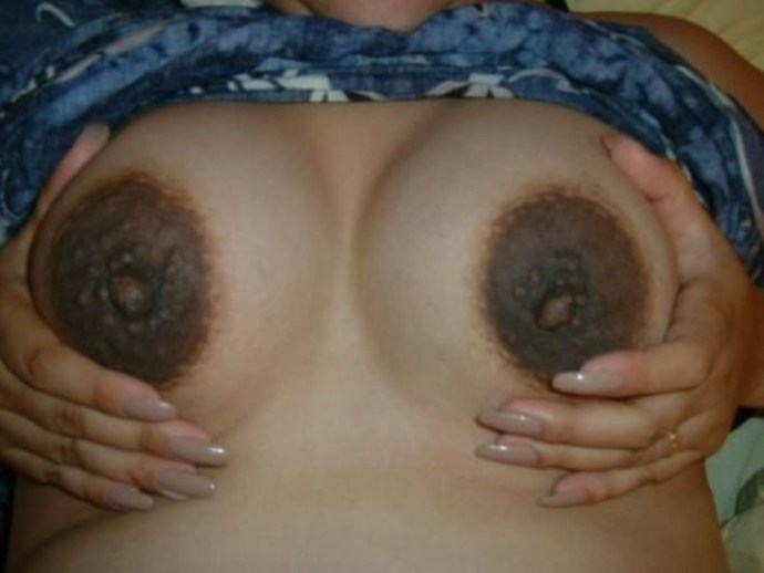 Huge halo around the nipples