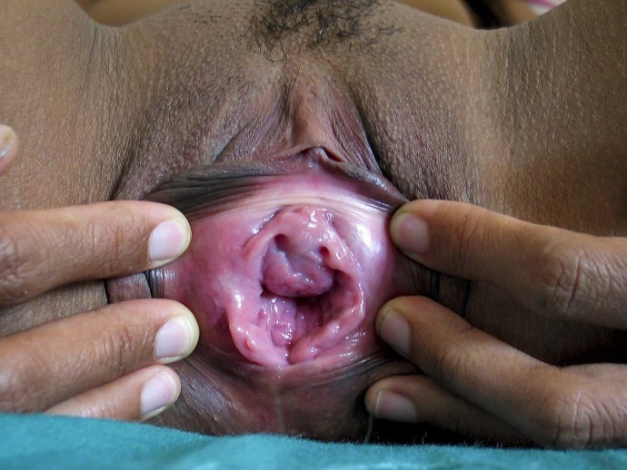 A video camera inside the vagina