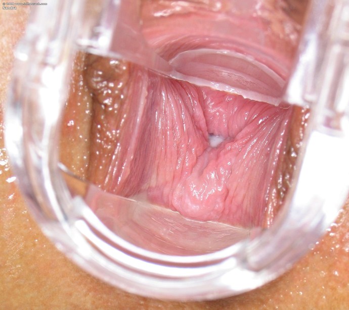 Women's vagina close -up