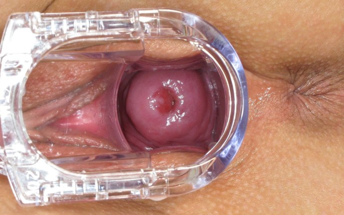 Vagina from the inside in the context