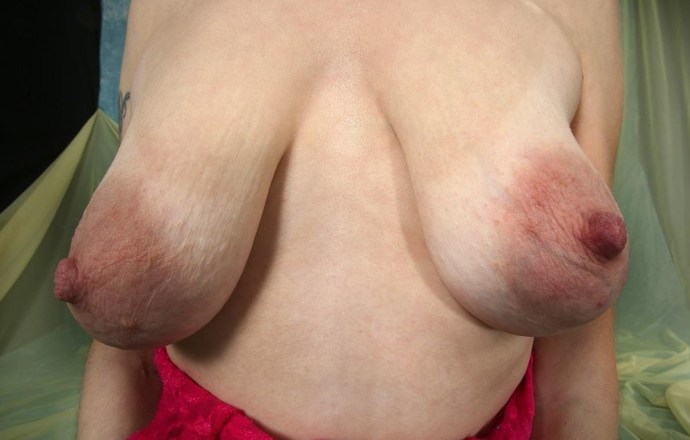 Naked women with sagging boobs