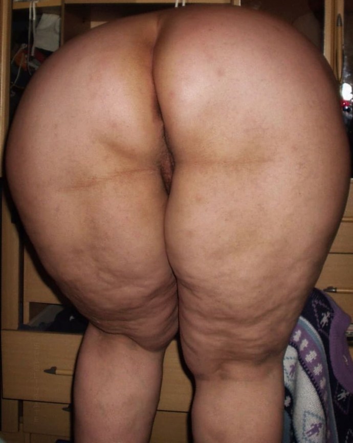 Naked cellulite women