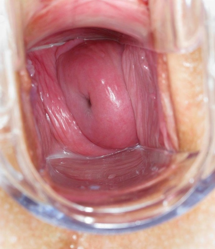The structure of the vagina from the inside