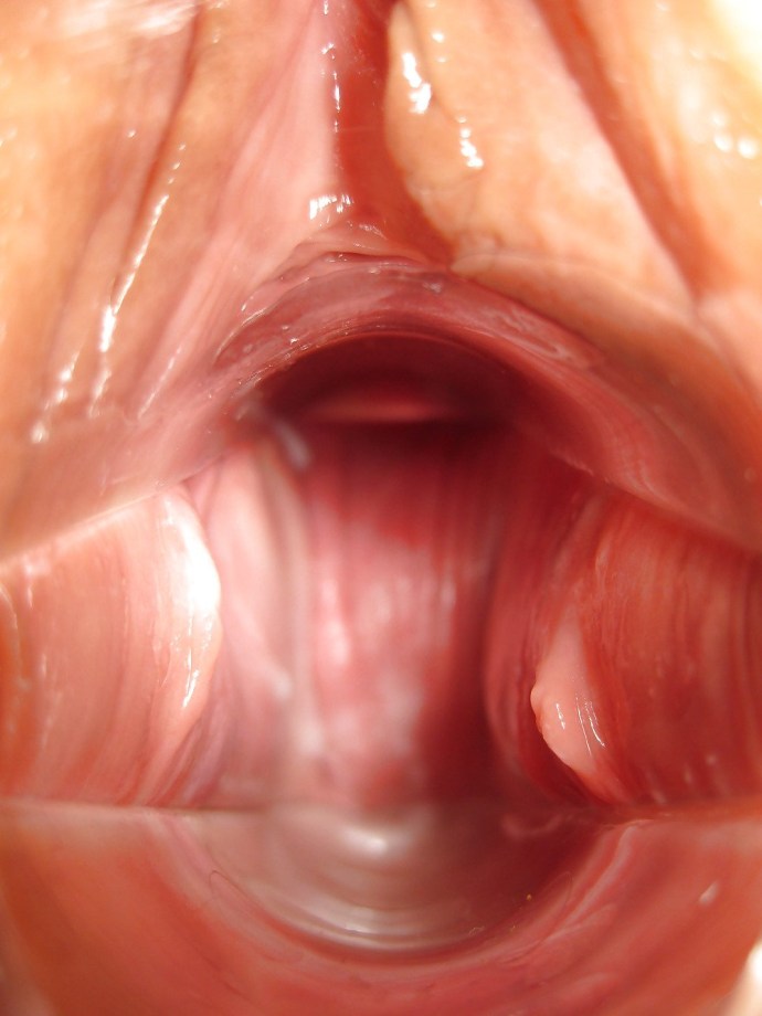 Inside the vagina is large