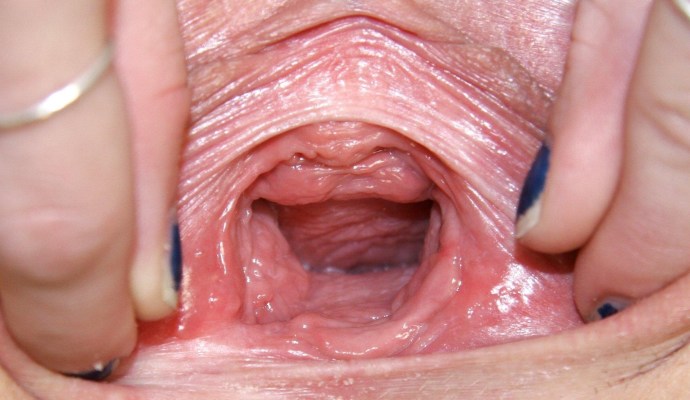 Healthy vagina from the inside
