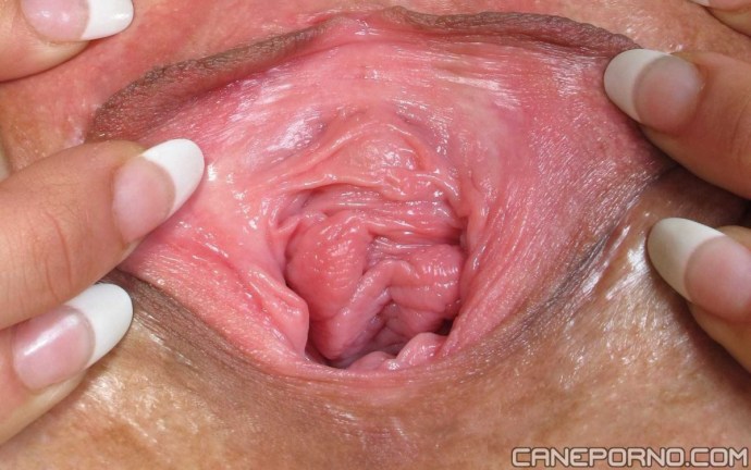 The walls of the vagina from the inside