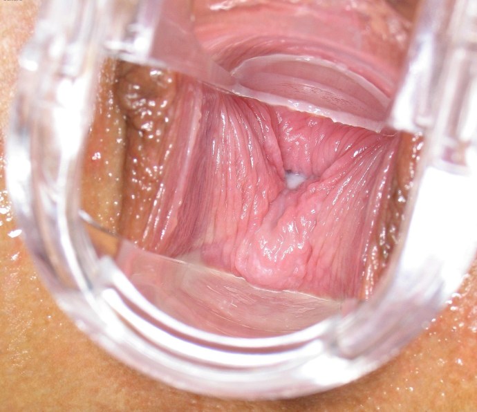 The camera inside the vagina