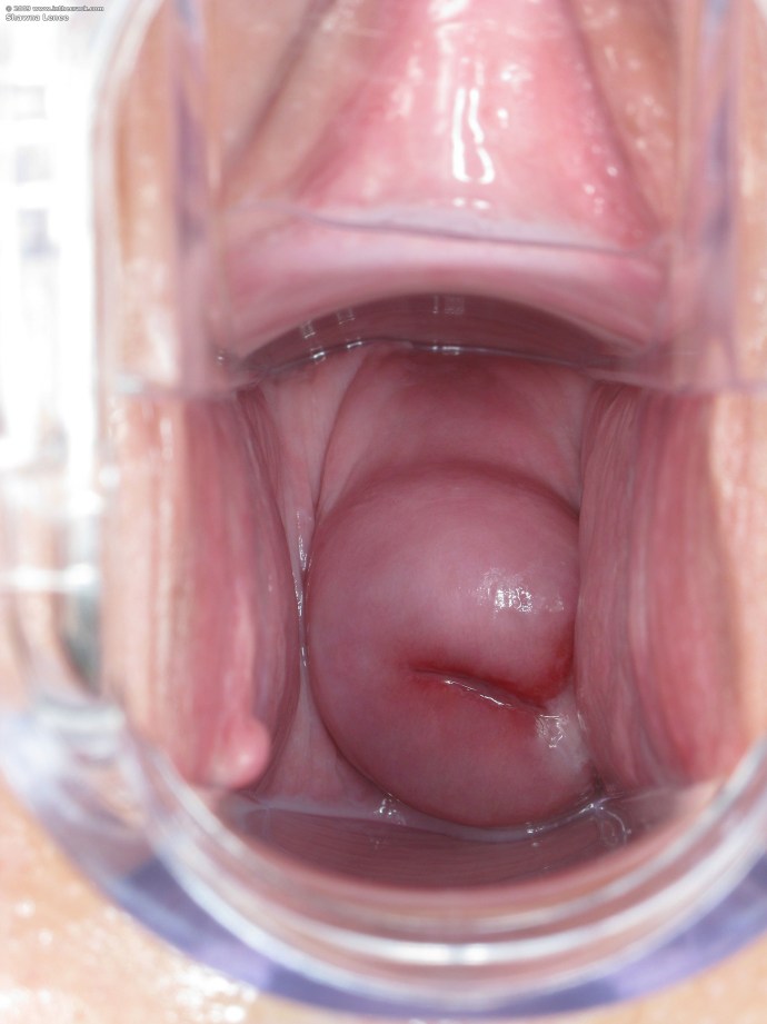 The inner type of vagina