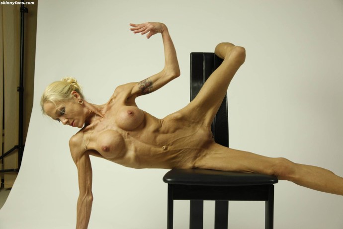 Naked women with anorexia