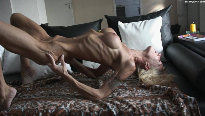 Anorexic girls nude