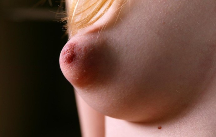 Large excited nipples