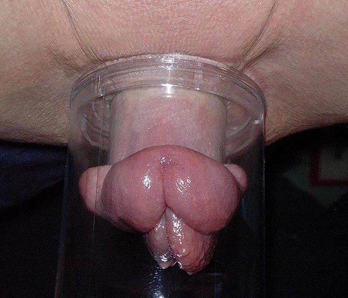Vagina after a vacuum pump