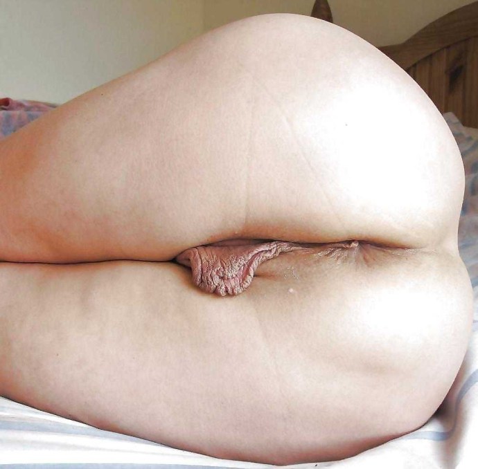 Huge puffy labia