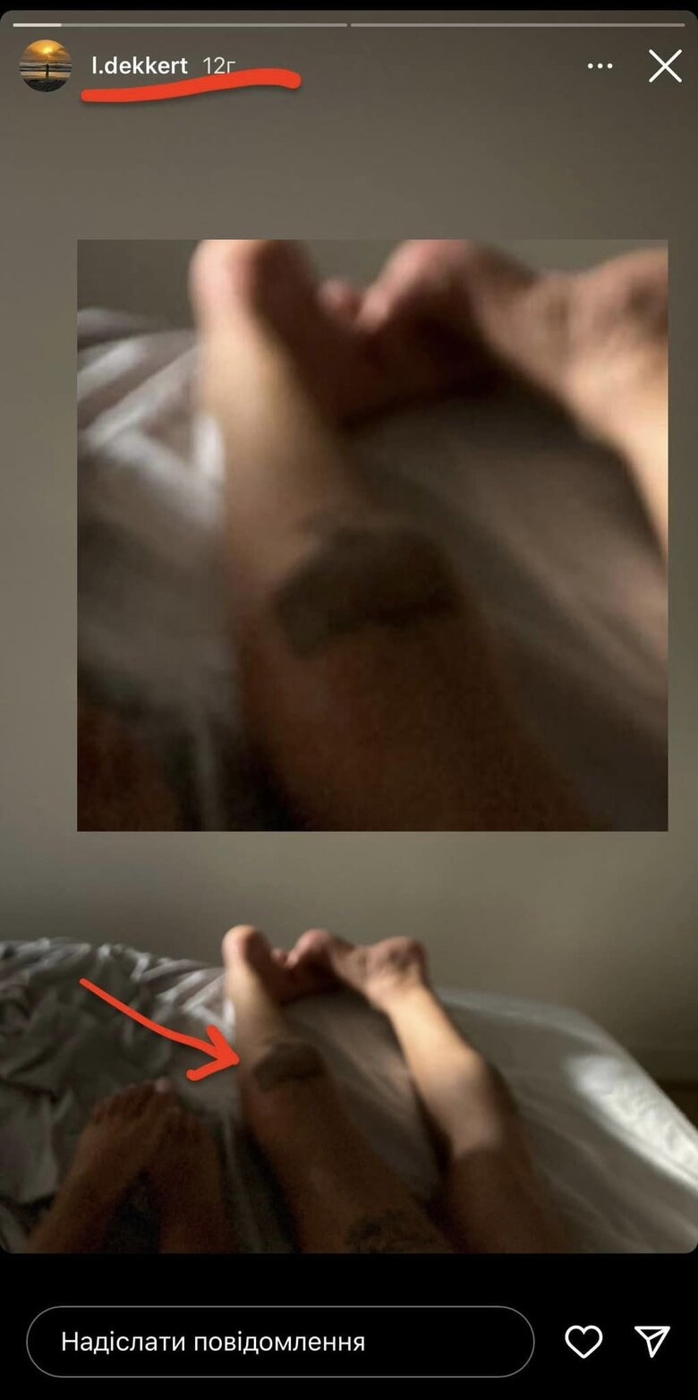 The girl's legs