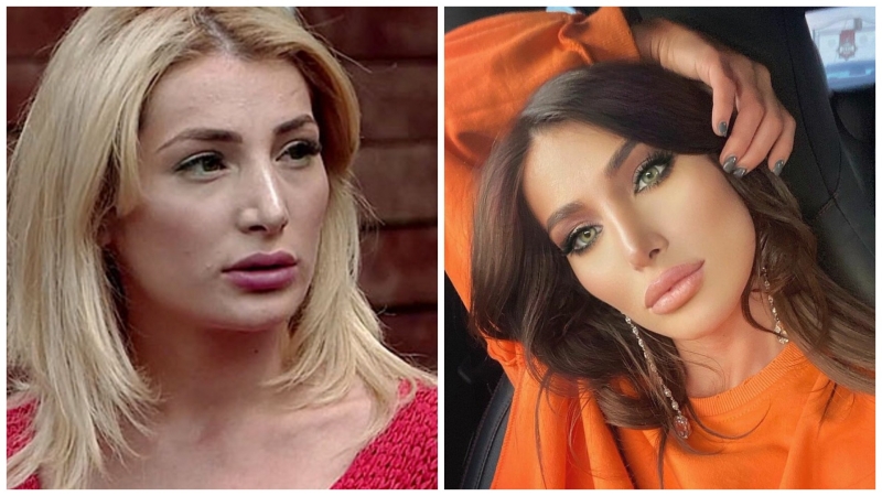 Tata Blumencrantz before and after plastic