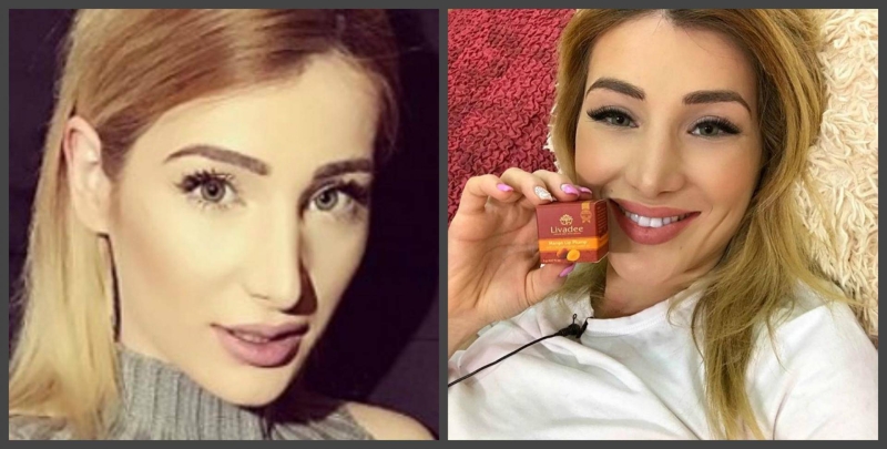Tata Blumencrantz before and after