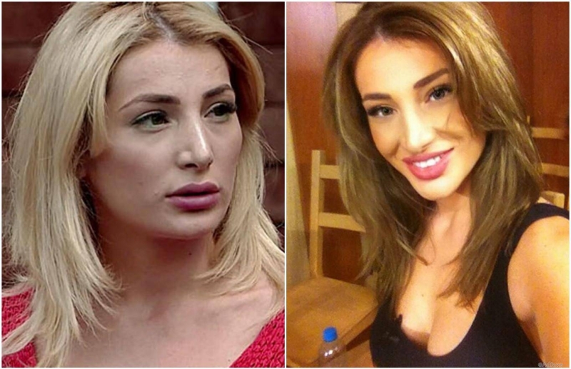 Tata Blumencrantz before and after