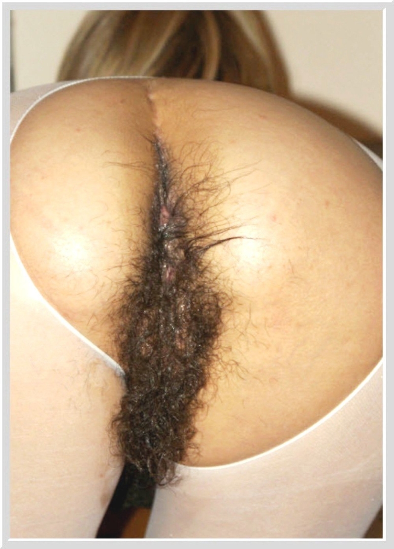 Hairy female ass
