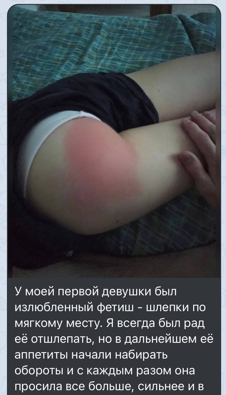 The swollen ass of the girl