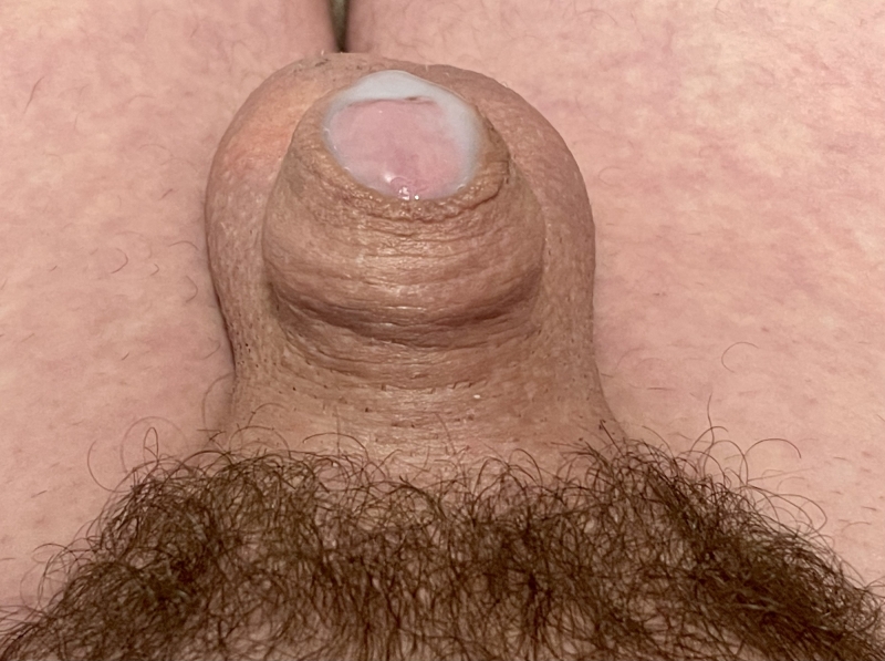 Micro member